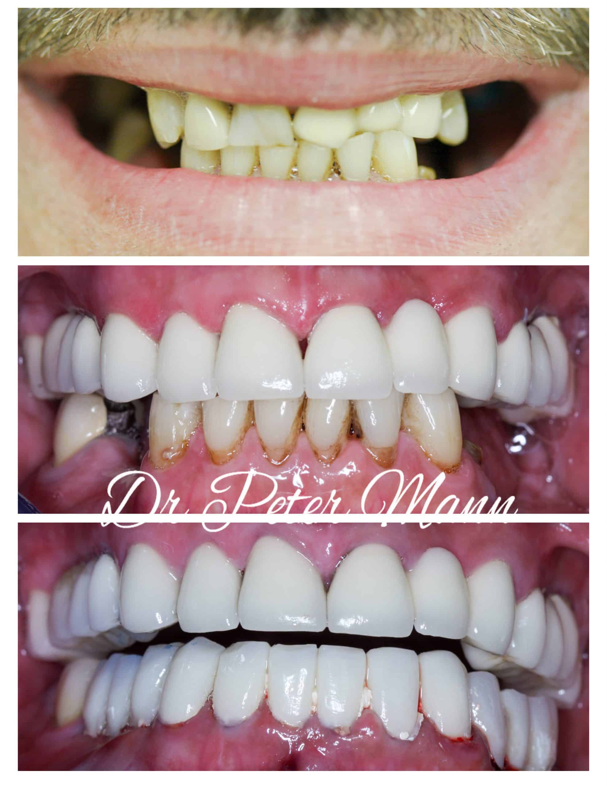 Smile Make Over Photo Gallery NYC Dentist Manhattan smile-make-over-photo-gallery-nyc-dentist-manhattan